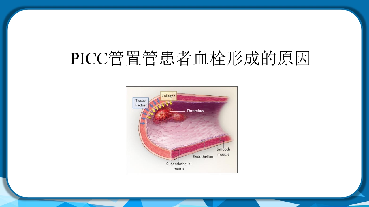 PICC导管相关性血栓形成及处理PPT课件27
