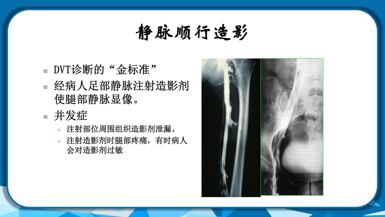 PICC导管相关性血栓形成及处理PPT课件35
