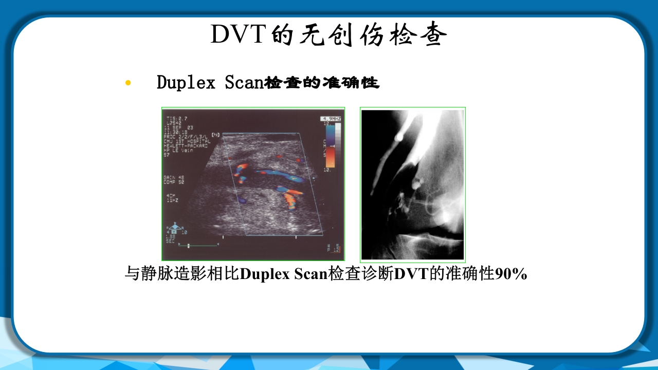 PICC导管相关性血栓形成及处理PPT课件36