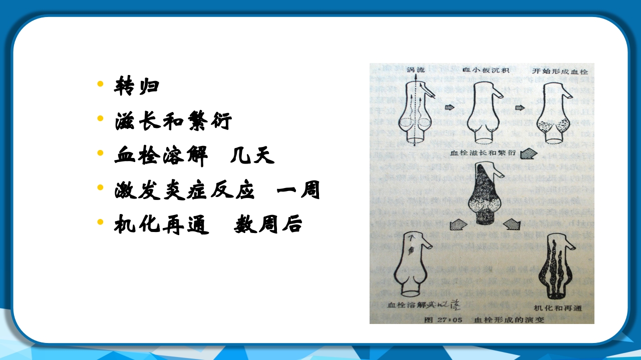 PICC导管相关性血栓形成及处理PPT课件41