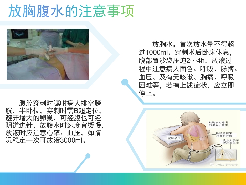 卵巢过度刺激综合征PPT课件21