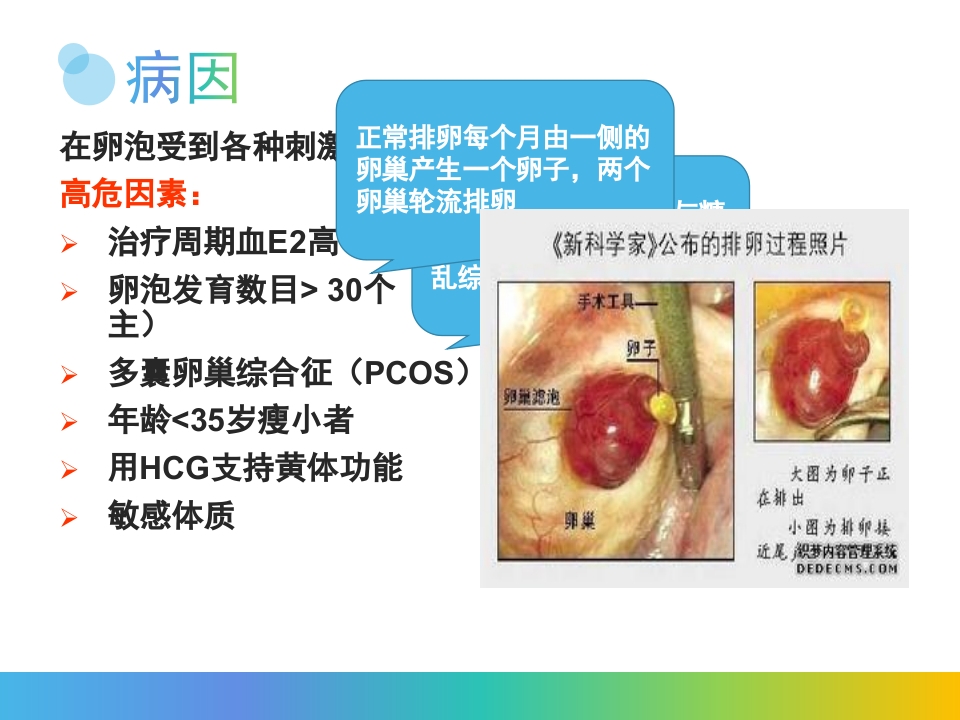卵巢过度刺激综合征PPT课件5