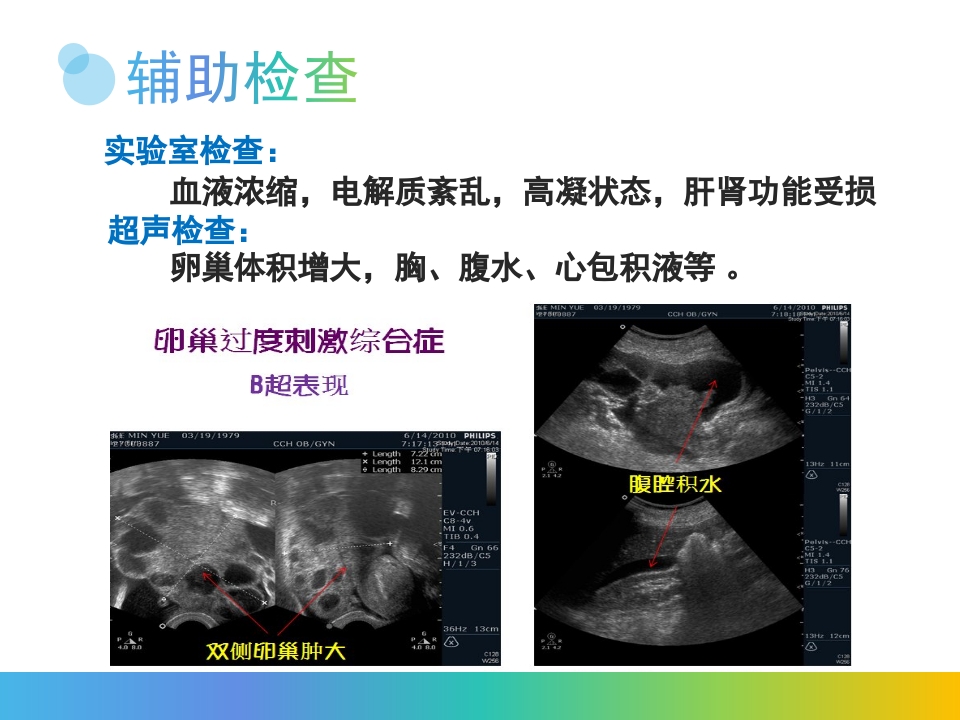 卵巢过度刺激综合征PPT课件8
