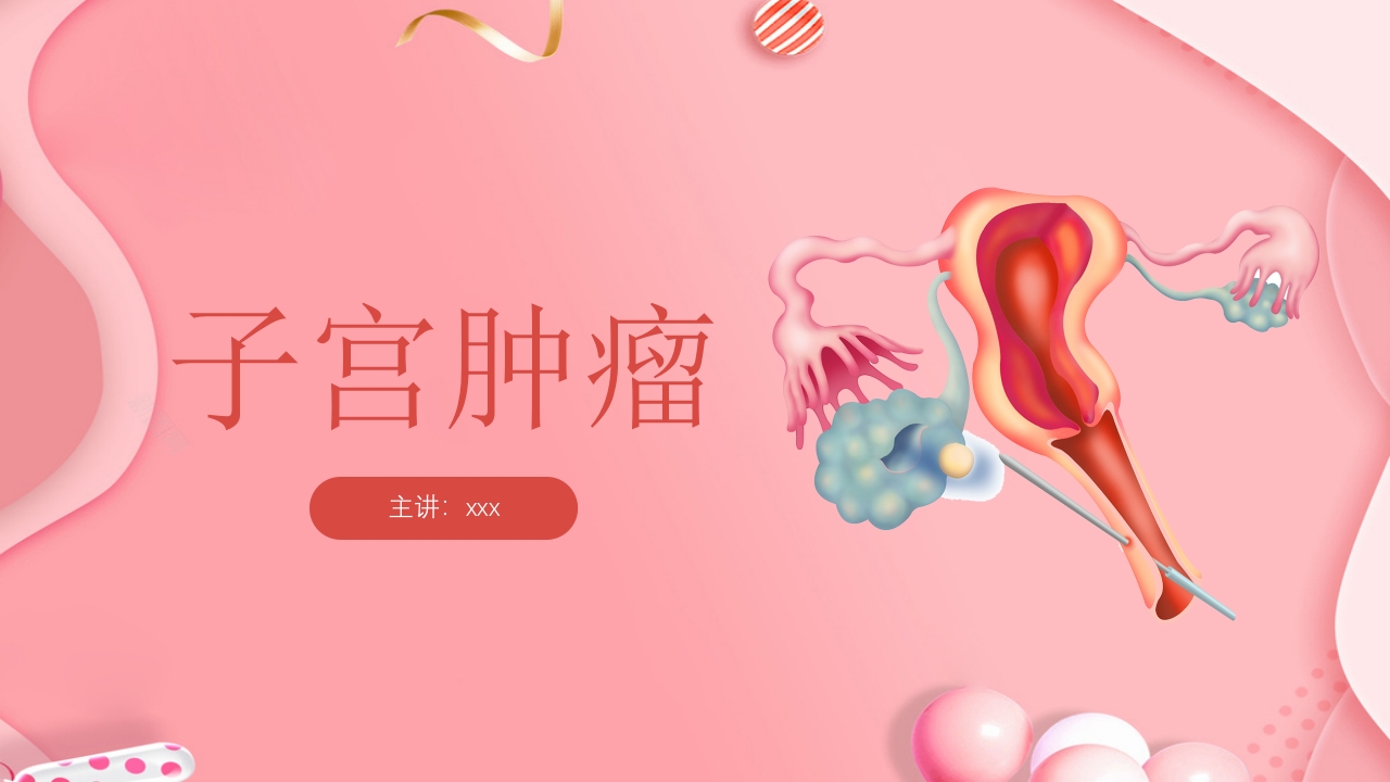 子宫肿瘤妇产科学课件PPT下载49