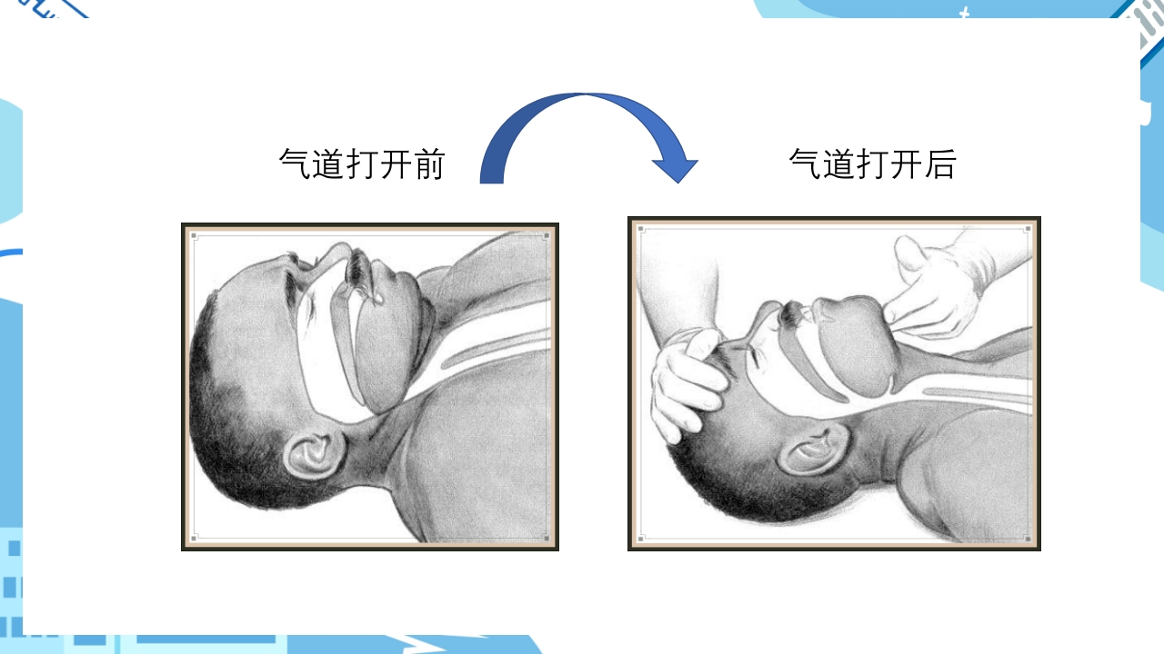 双人心肺复苏CPR+AEDppt课件11