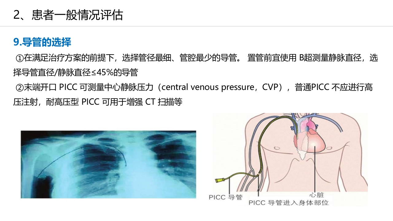 经外周静脉穿刺中心静脉置管(PICC)操作技术专家共识解读（2023版）PPT课件18