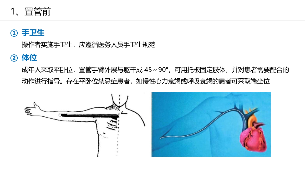 经外周静脉穿刺中心静脉置管(PICC)操作技术专家共识解读（2023版）PPT课件20