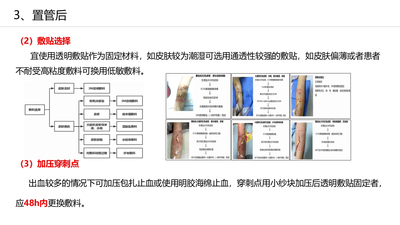 经外周静脉穿刺中心静脉置管(PICC)操作技术专家共识解读（2023版）PPT课件32