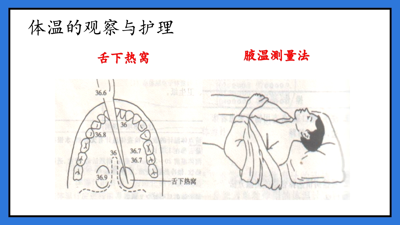 体温脉搏的测量生命体征的观察与护理PPT课件26