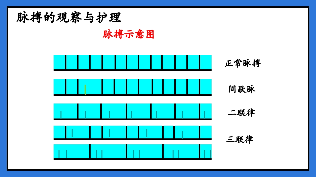 体温脉搏的测量生命体征的观察与护理PPT课件29