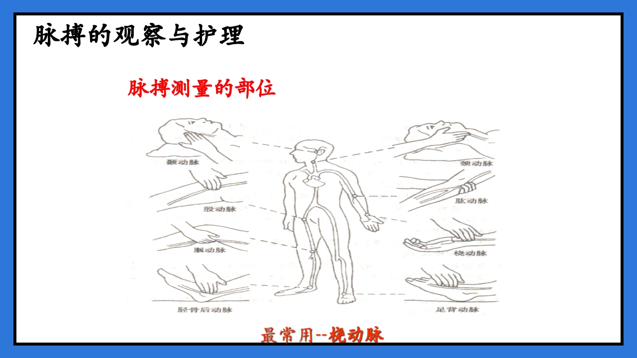 体温脉搏的测量生命体征的观察与护理PPT课件31