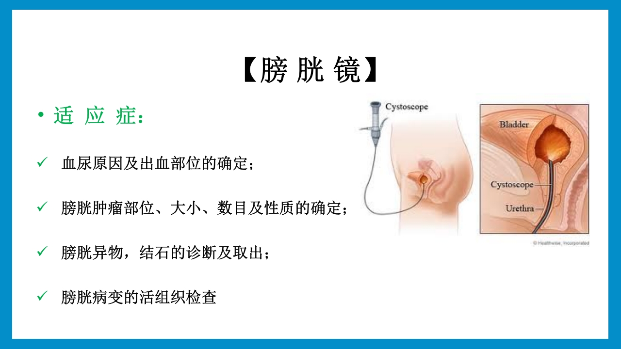 泌尿外科常见检查及其注意事项PPT课件10