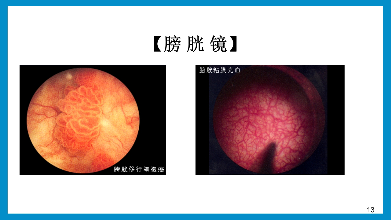 泌尿外科常见检查及其注意事项PPT课件13