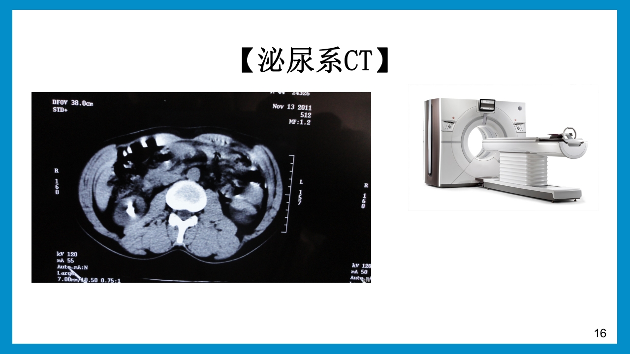 泌尿外科常见检查及其注意事项PPT课件16