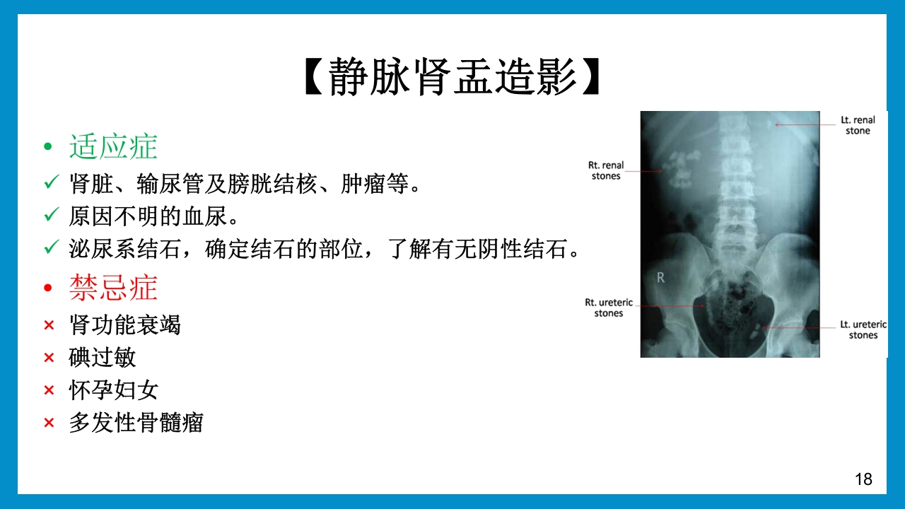 泌尿外科常见检查及其注意事项PPT课件18