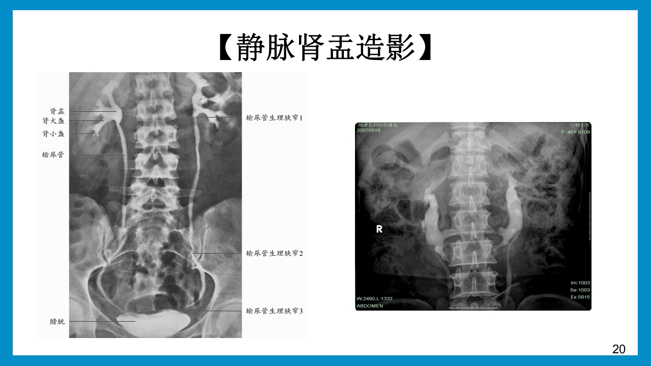 泌尿外科常见检查及其注意事项PPT课件20