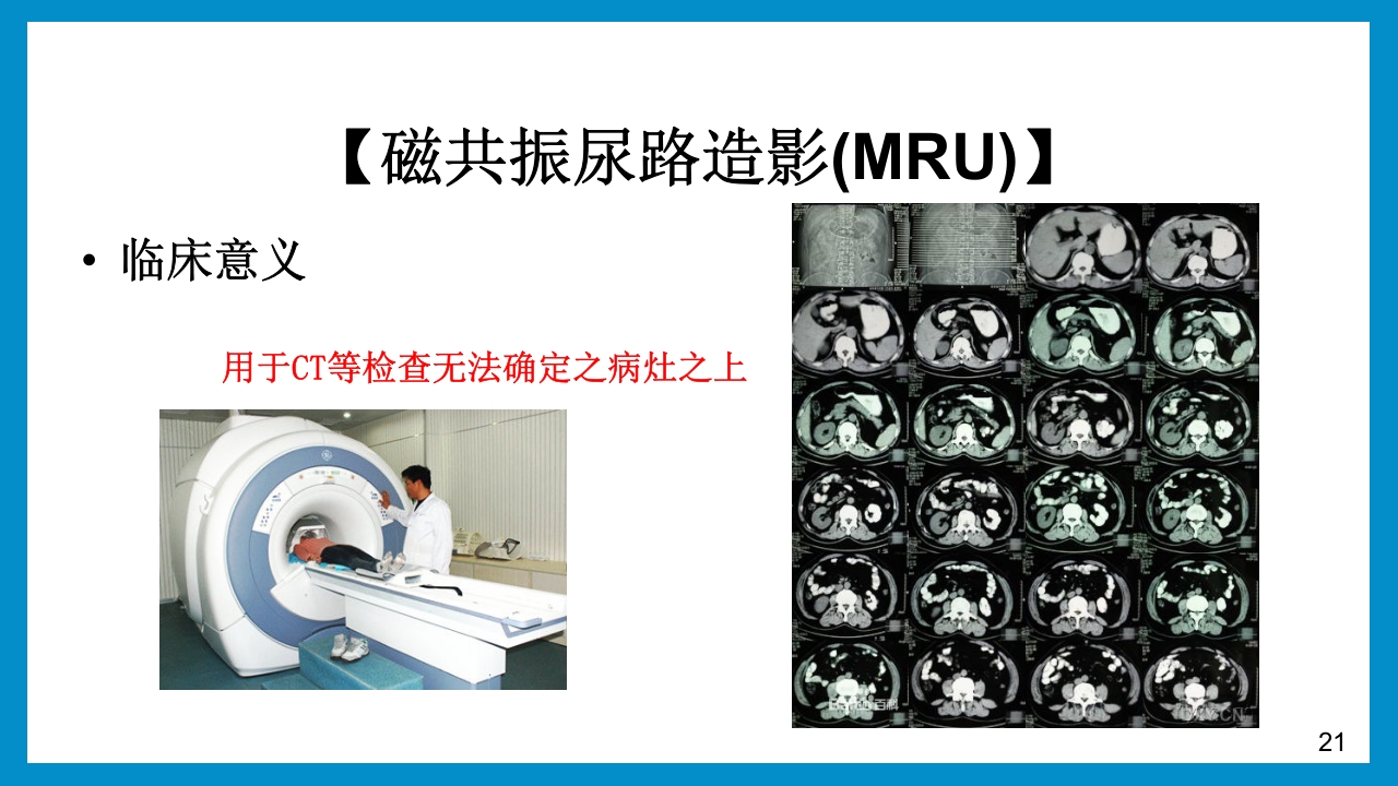 泌尿外科常见检查及其注意事项PPT课件21