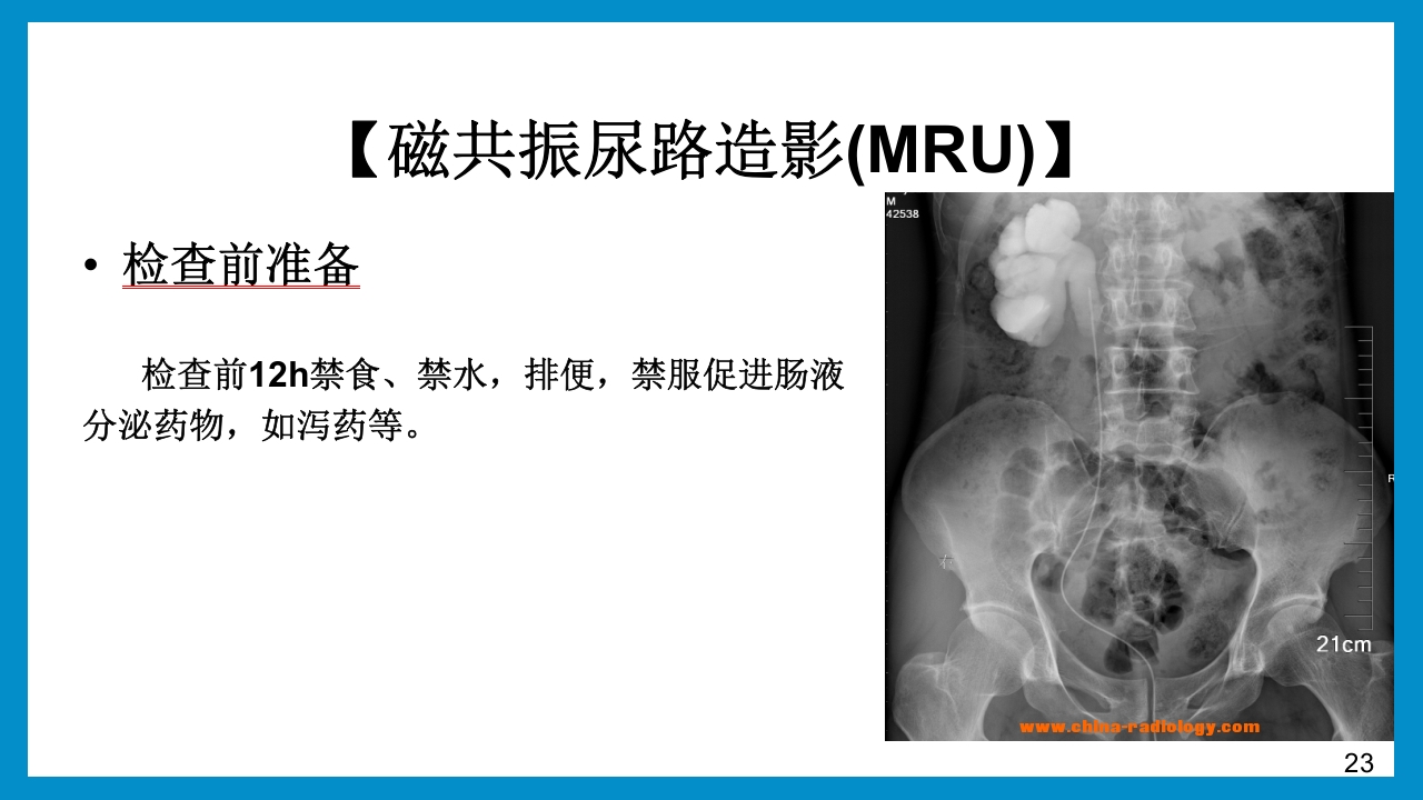 泌尿外科常见检查及其注意事项PPT课件23