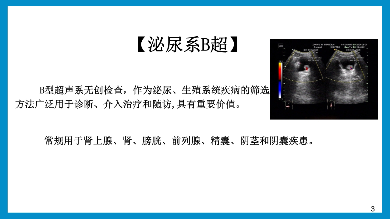 泌尿外科常见检查及其注意事项PPT课件3