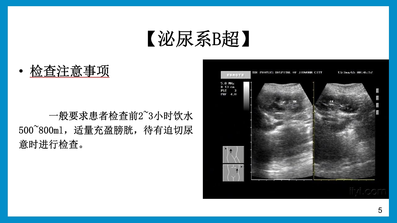 泌尿外科常见检查及其注意事项PPT课件5