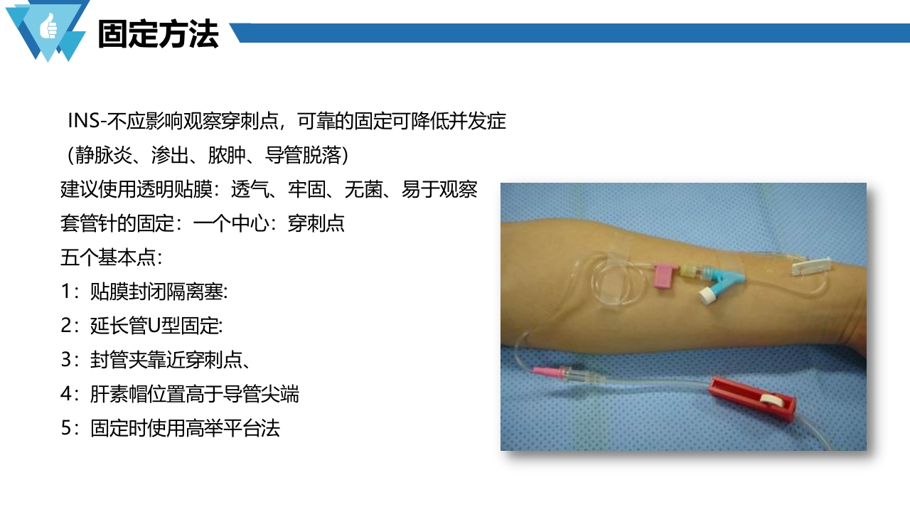 套管针介绍医疗PPT课件9