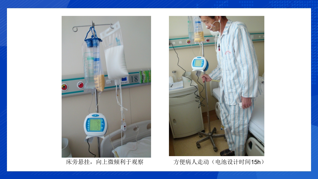 鼻饲泵的使用PPT课件10