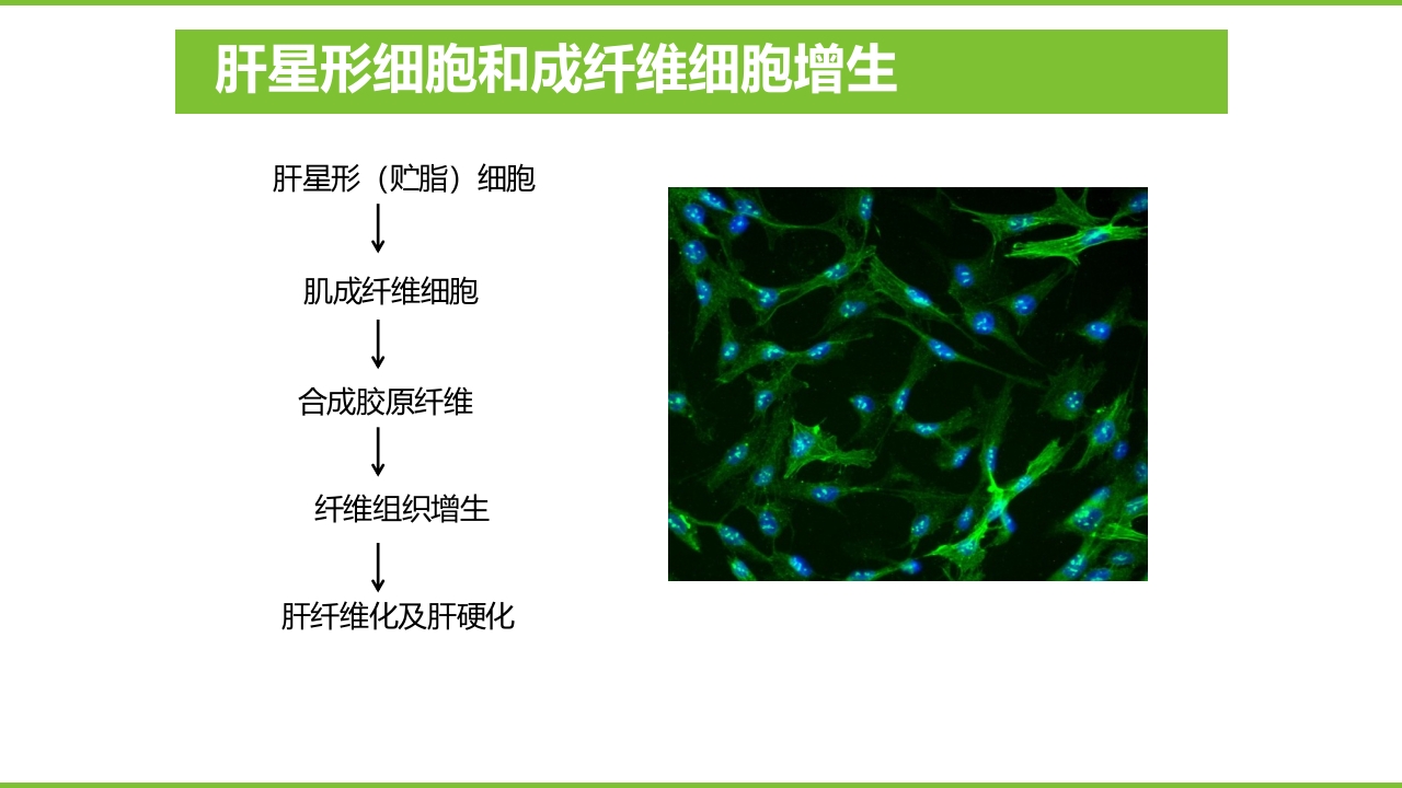 肝硬化PPT课件16