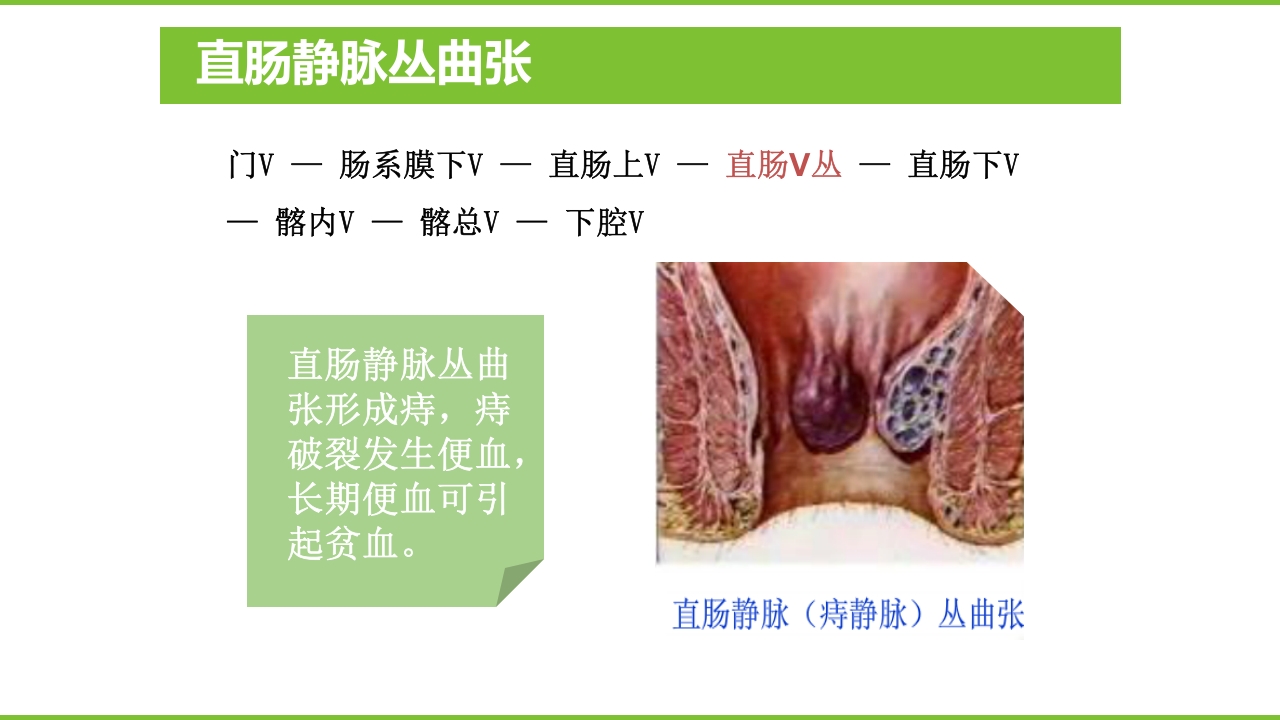 肝硬化PPT课件40