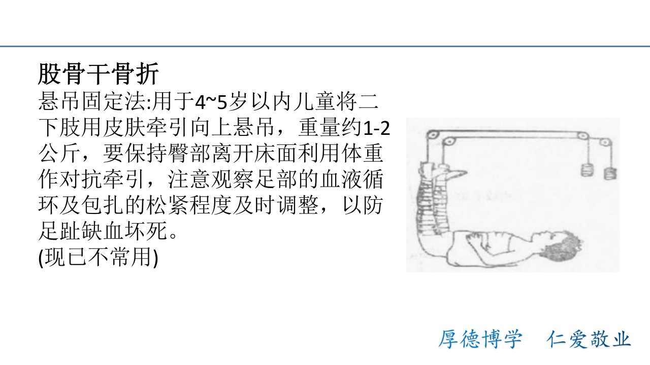 骨折病人的体位护理PPT课件13