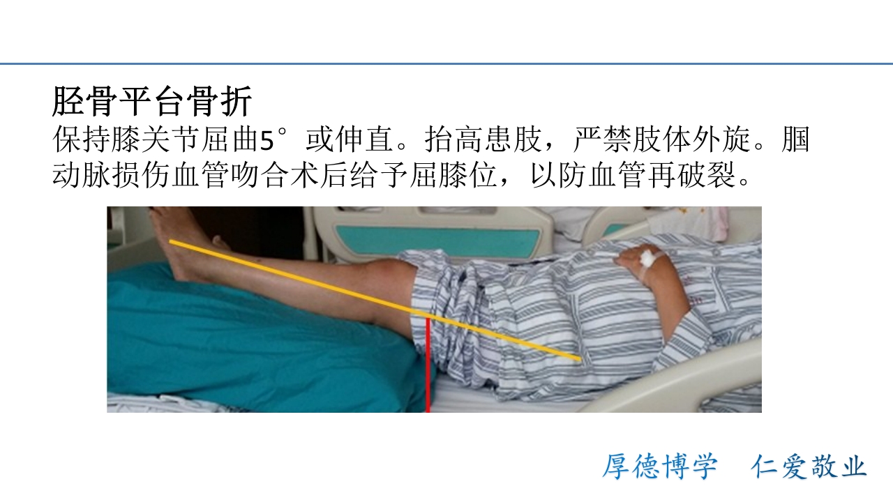 骨折病人的体位护理PPT课件14