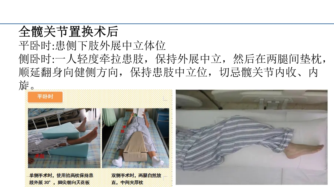 骨折病人的体位护理PPT课件17