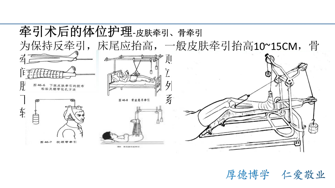 骨折病人的体位护理PPT课件21