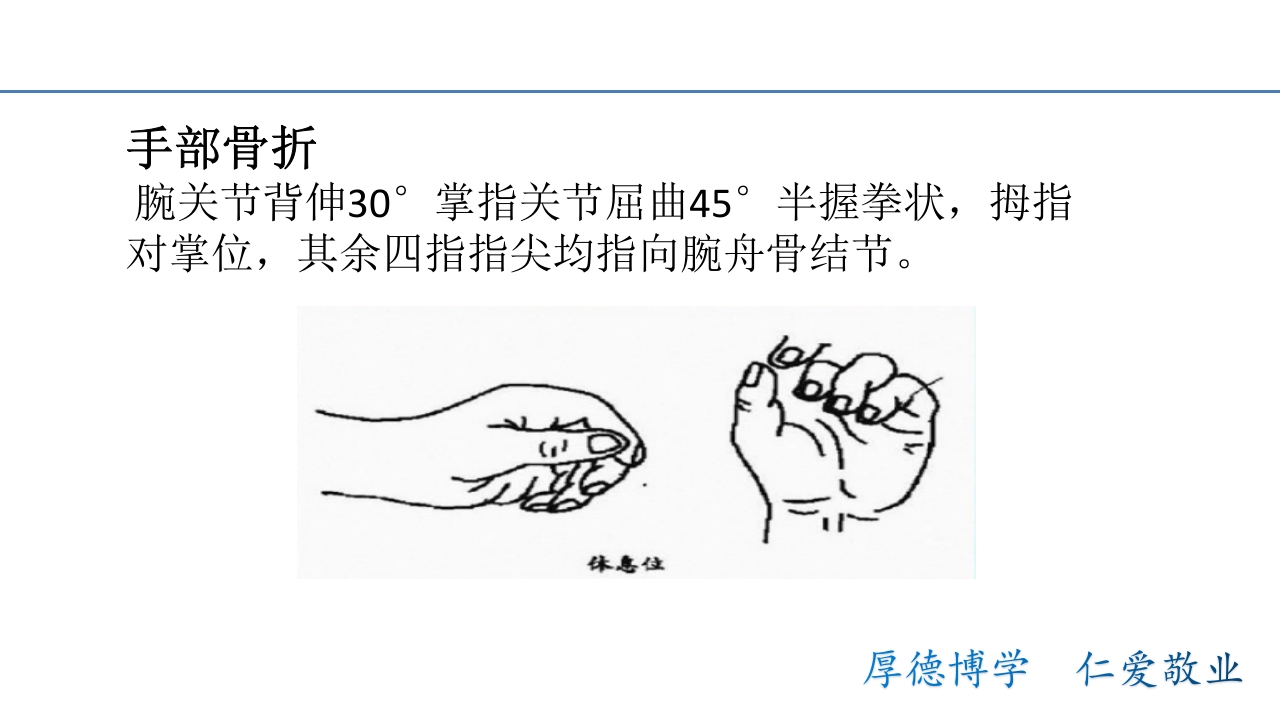 骨折病人的体位护理PPT课件8