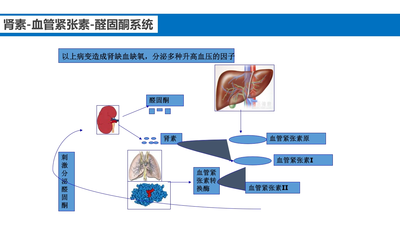 继发性高血压鉴别诊断PPT课件10