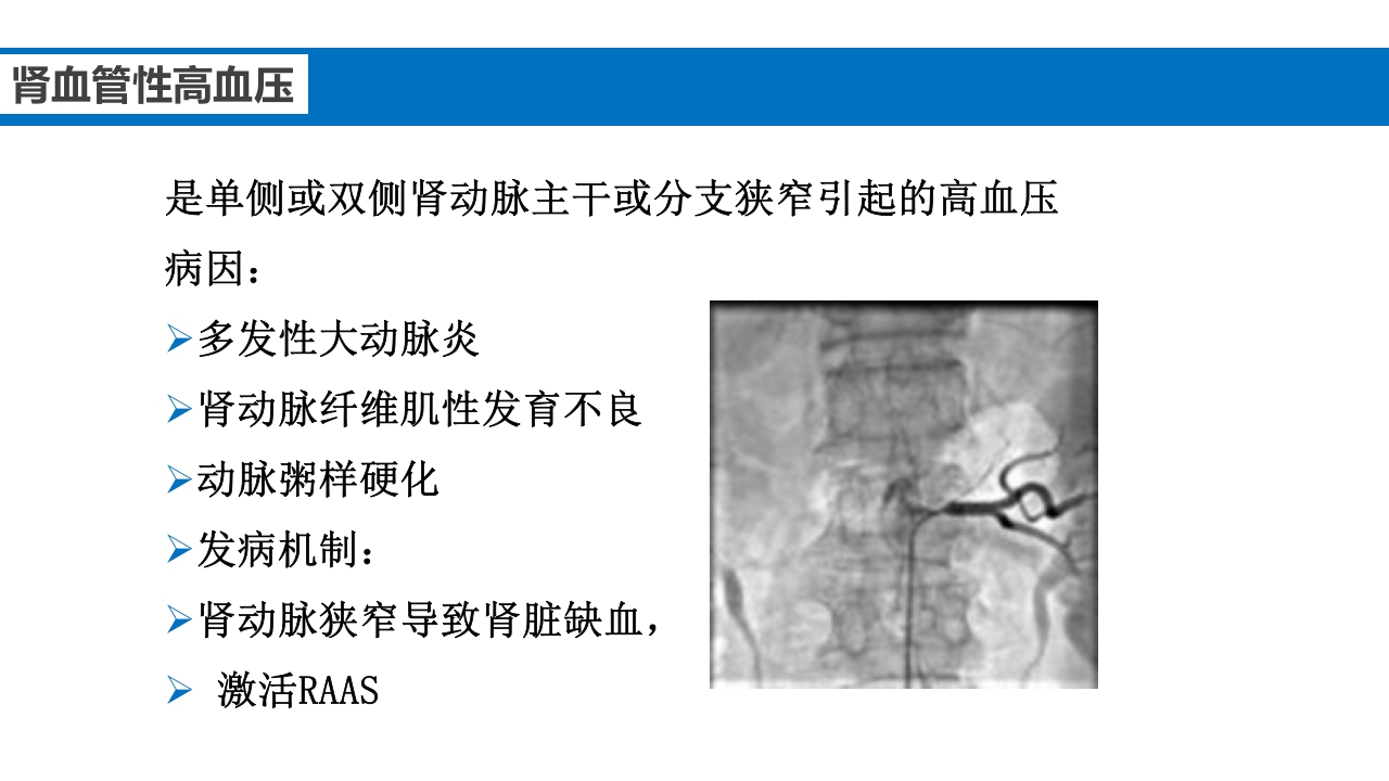 继发性高血压鉴别诊断PPT课件22