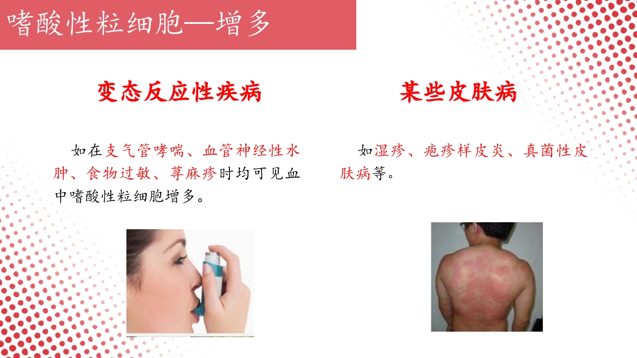 血常规·血红蛋白PPT课件46