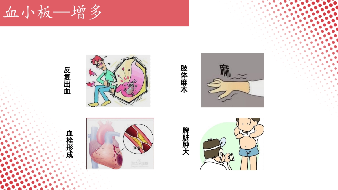 血常规·血红蛋白PPT课件66