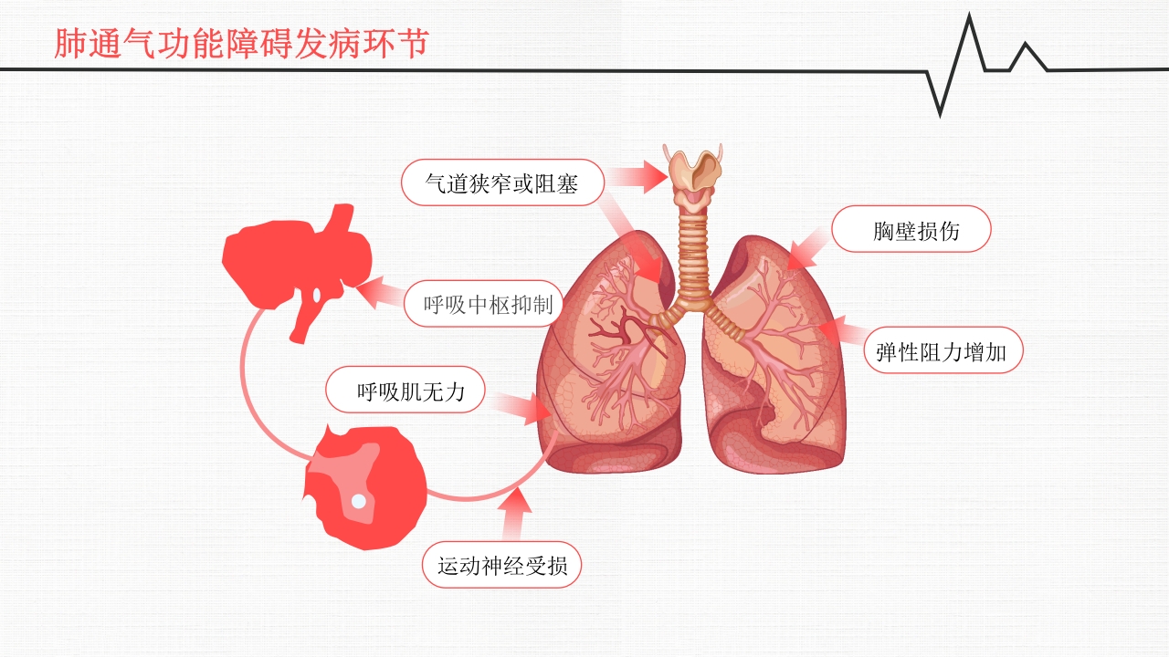 呼吸衰竭PPT课件9