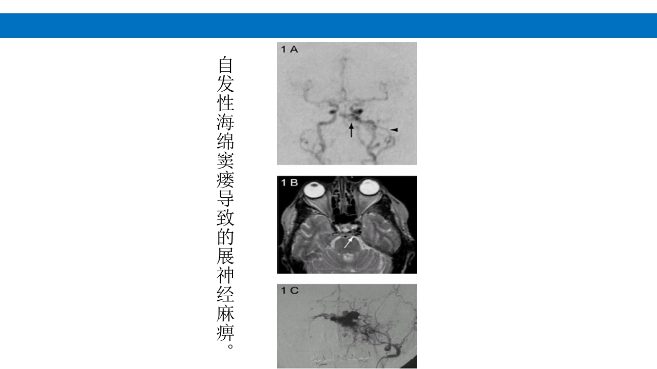 颅脑损伤的并发症及后遗症PPT课件49