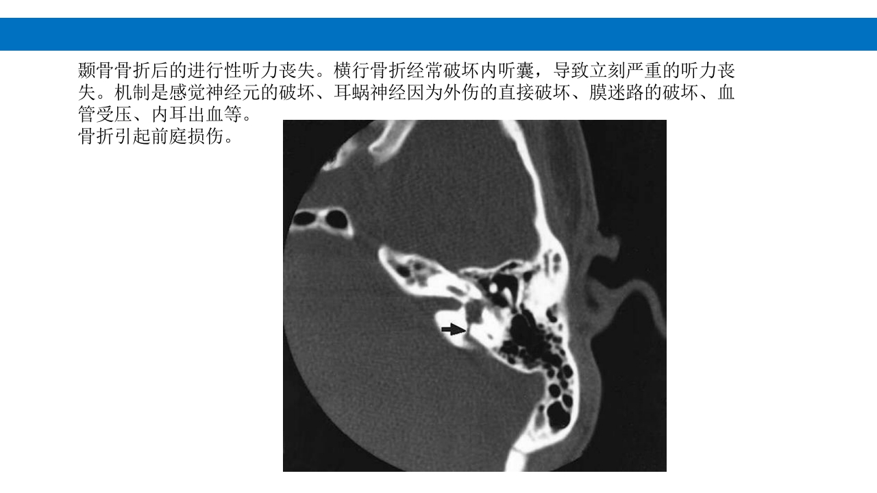 颅脑损伤的并发症及后遗症PPT课件55