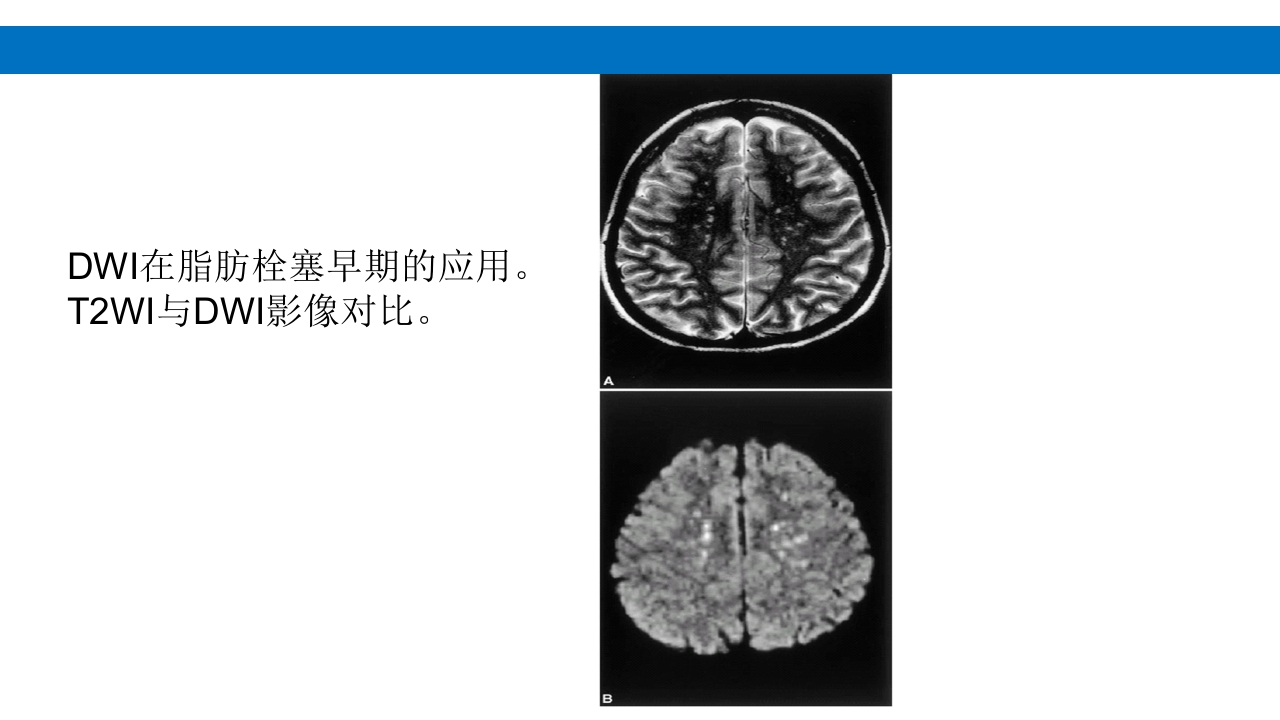 颅脑损伤的并发症及后遗症PPT课件69