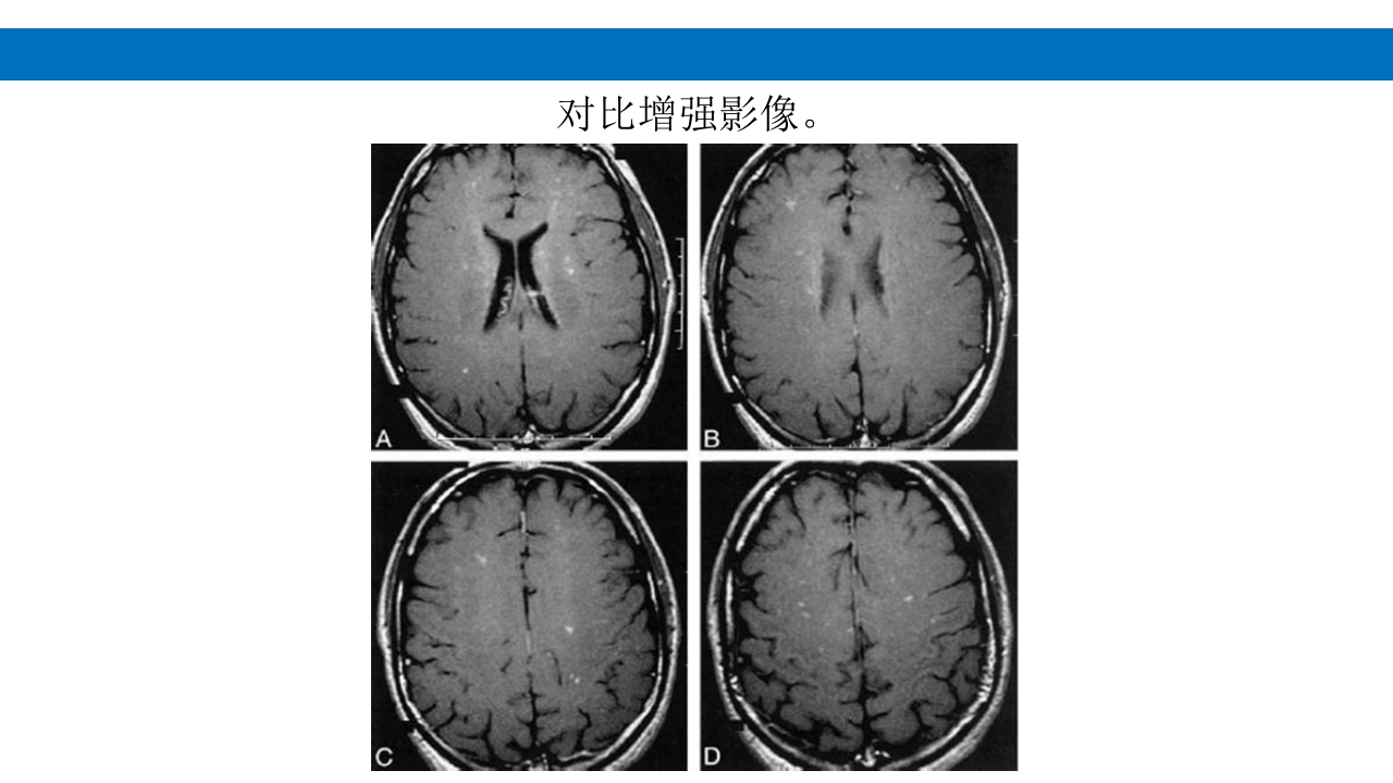 颅脑损伤的并发症及后遗症PPT课件71