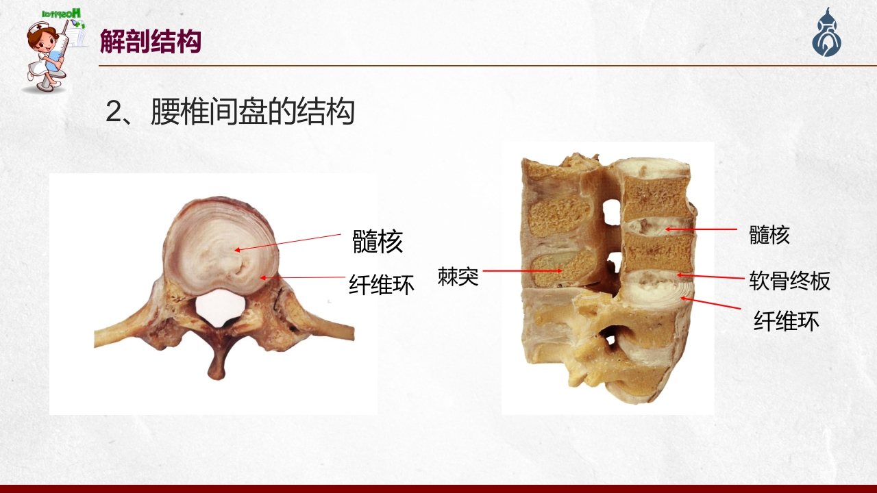 腰椎间盘突出患者护理查房PPT课件11