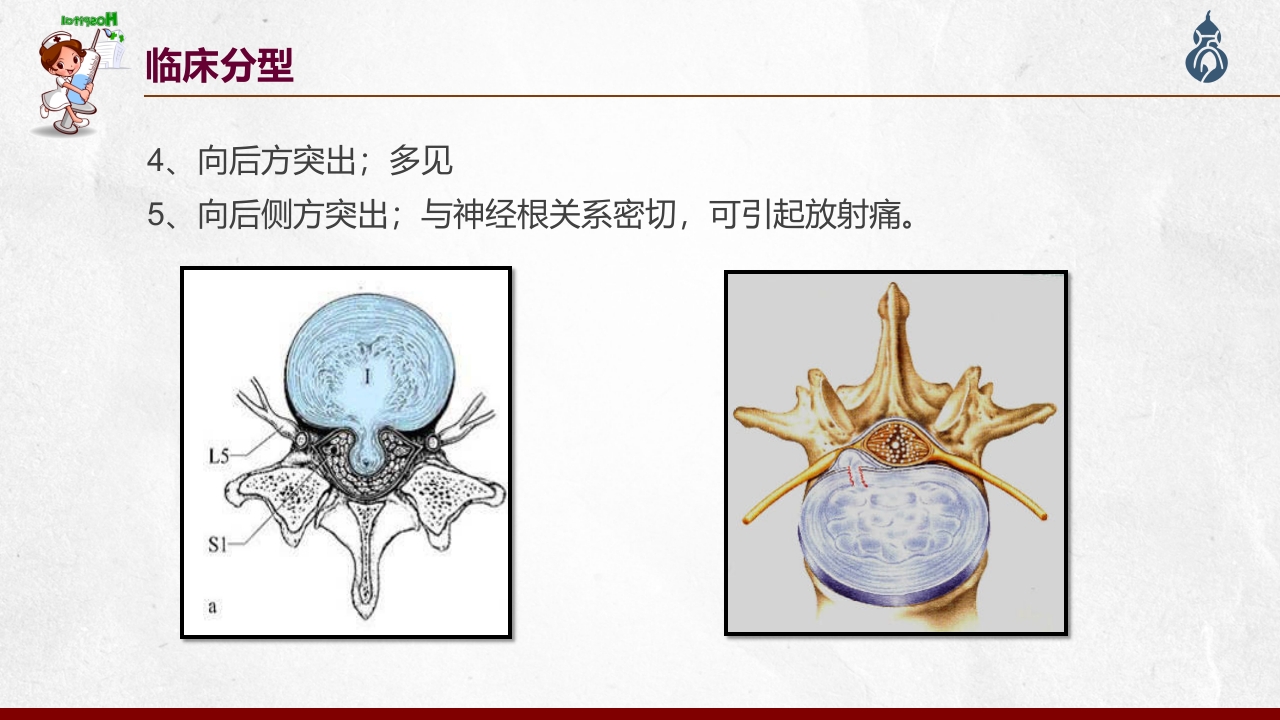 腰椎间盘突出患者护理查房PPT课件21