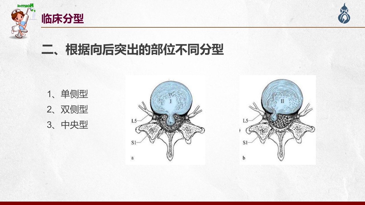 腰椎间盘突出患者护理查房PPT课件22