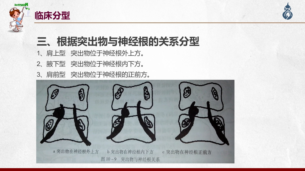 腰椎间盘突出患者护理查房PPT课件23