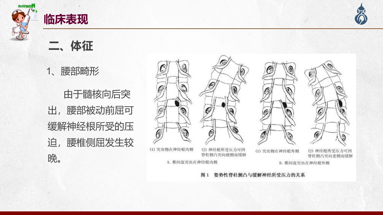 腰椎间盘突出患者护理查房PPT课件30