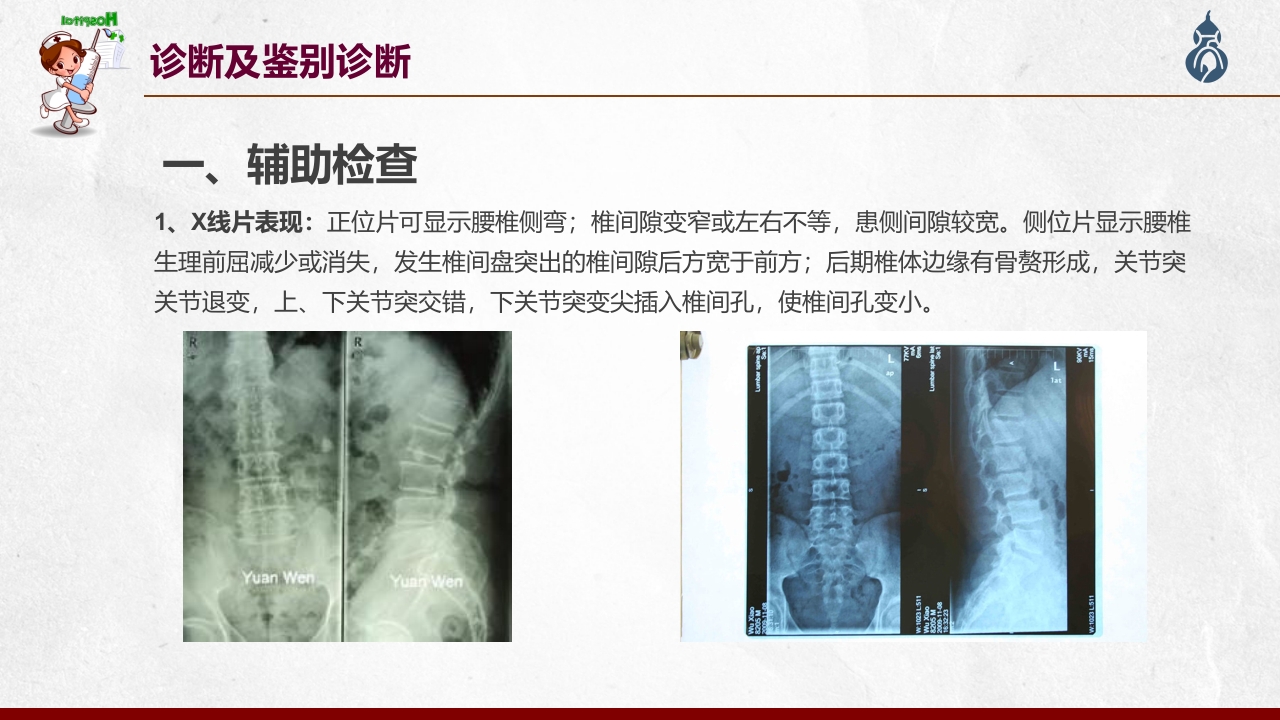 腰椎间盘突出患者护理查房PPT课件38