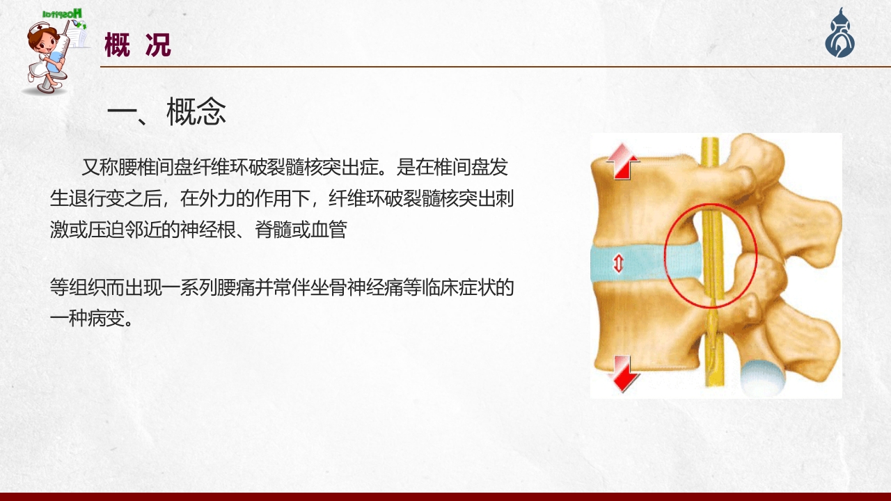 腰椎间盘突出患者护理查房PPT课件3