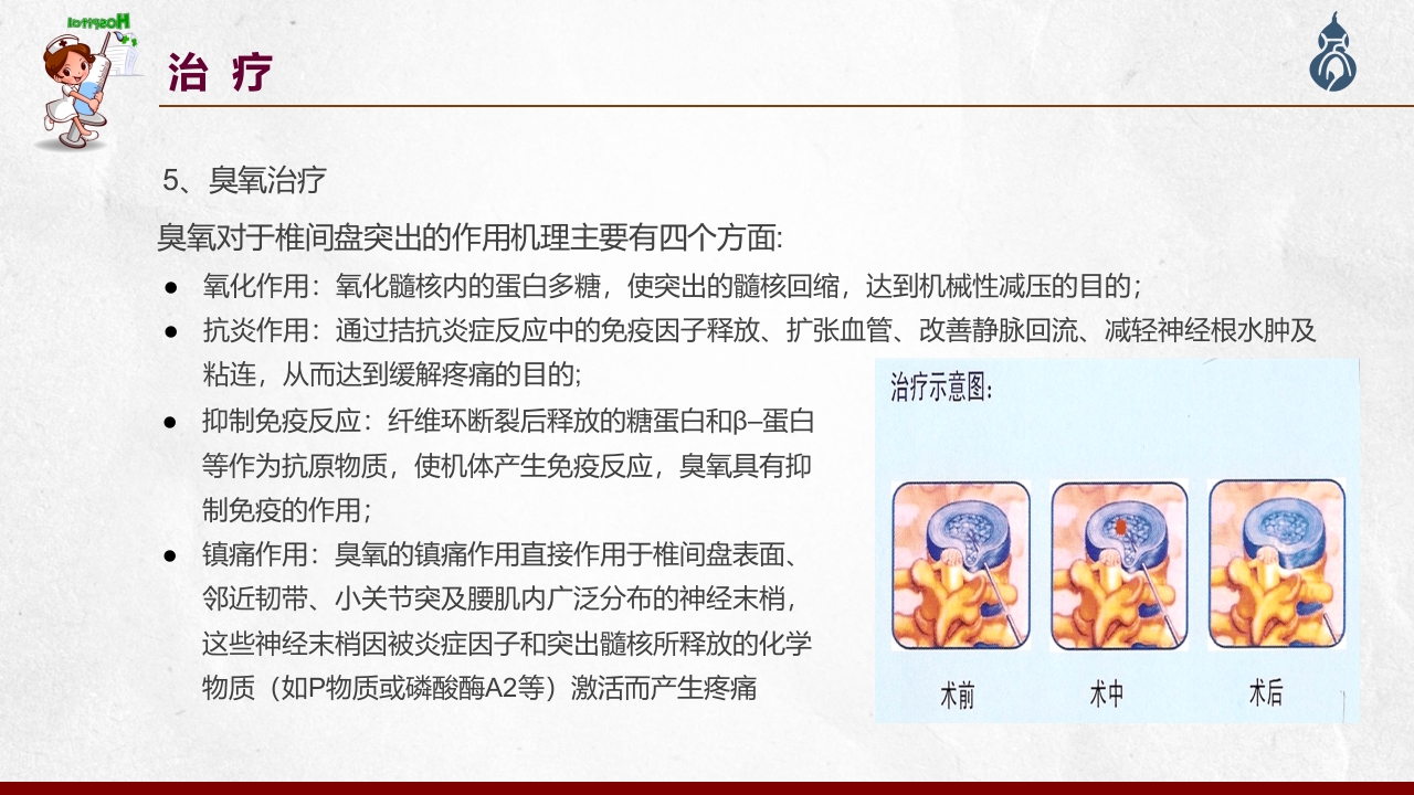 腰椎间盘突出患者护理查房PPT课件62